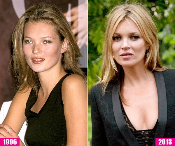 Kate Moss…