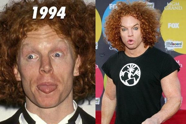 Carrot Top