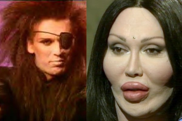 Pete Burns