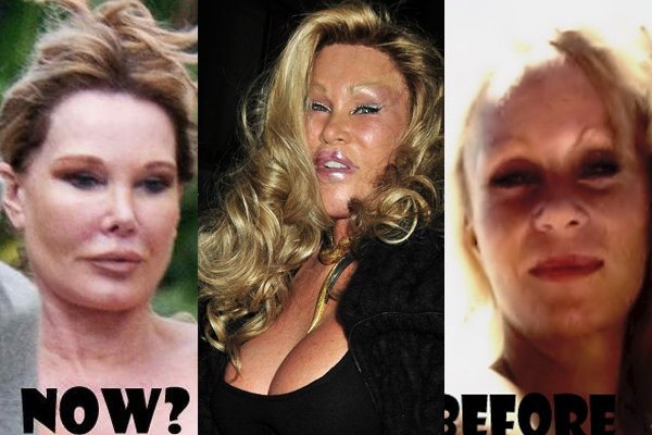 Jocelyn Wildenstein