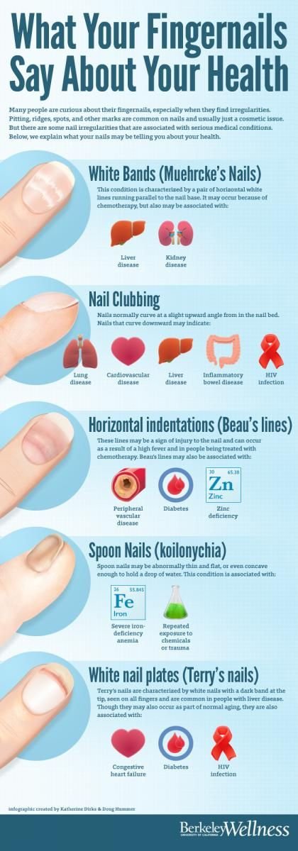 What Your Fingernails Say about Your Health