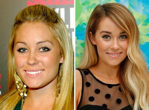 Lauren Conrad