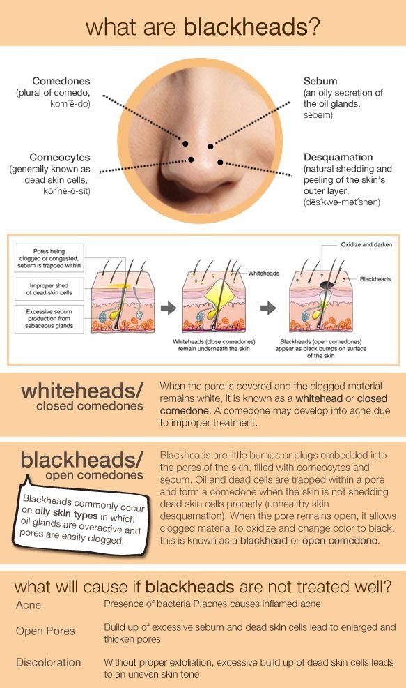 diagram,biology,line,brand,presentation,