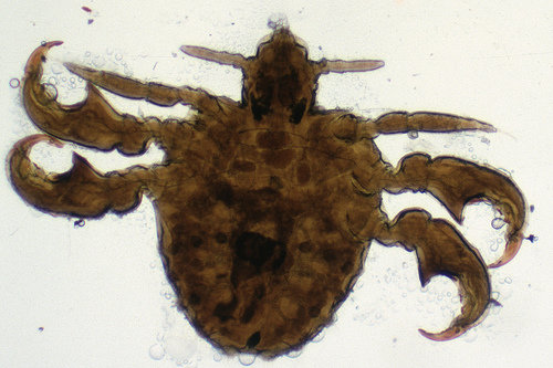 Pubic Lice (Crabs) and Scabies