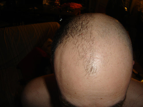 Half-shaved Head