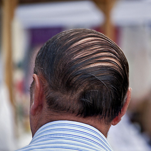 The Comb-over