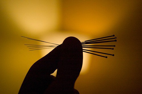 Acupuncture or Acupressure