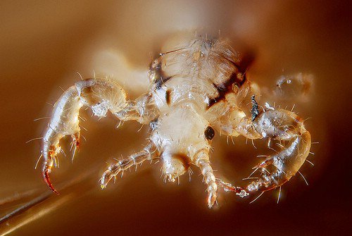 Make Sure That You do Not Have Head Lice