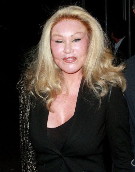 Jocelyn Wildenstein