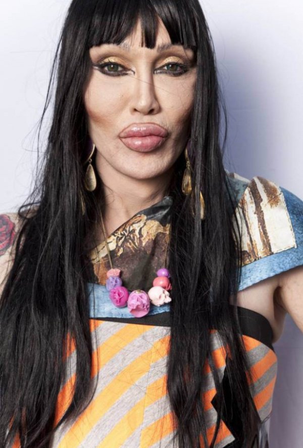 Pete Burns