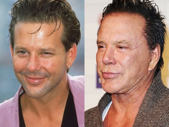 Mickey Rourke