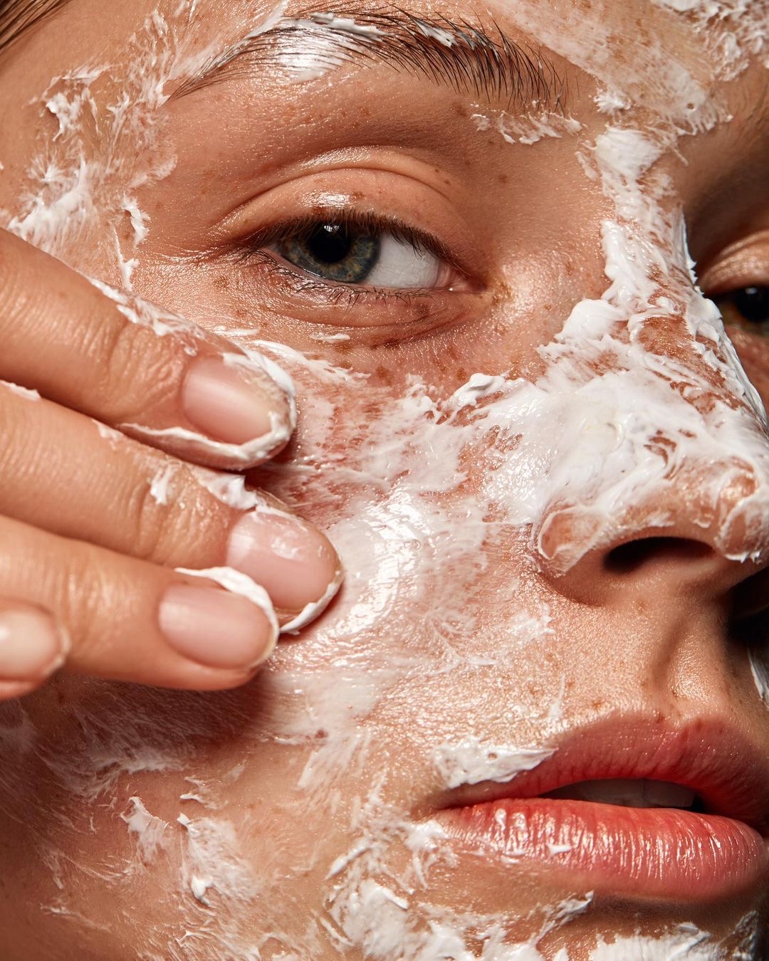 10 Quick Ways to Get Rid of a Pimple for Girls Needing to Look Fab ASAP ...